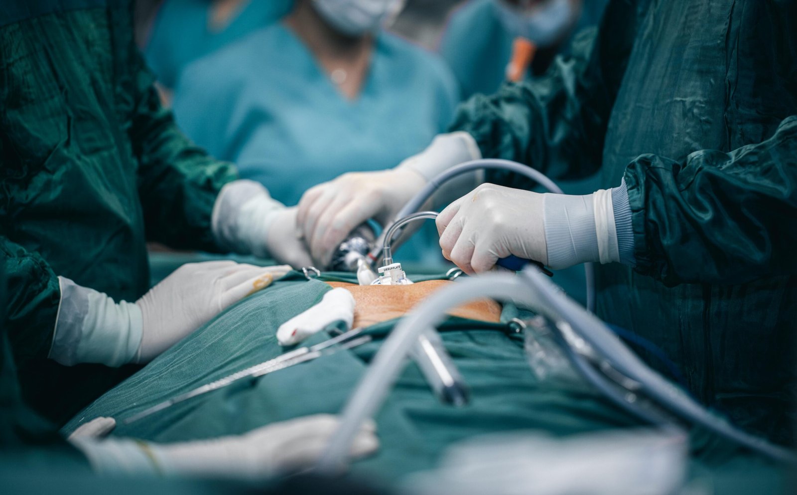 Laparoscopic Surgery in Vadodara: Faster Recovery, Less Pain, Better Outcomes